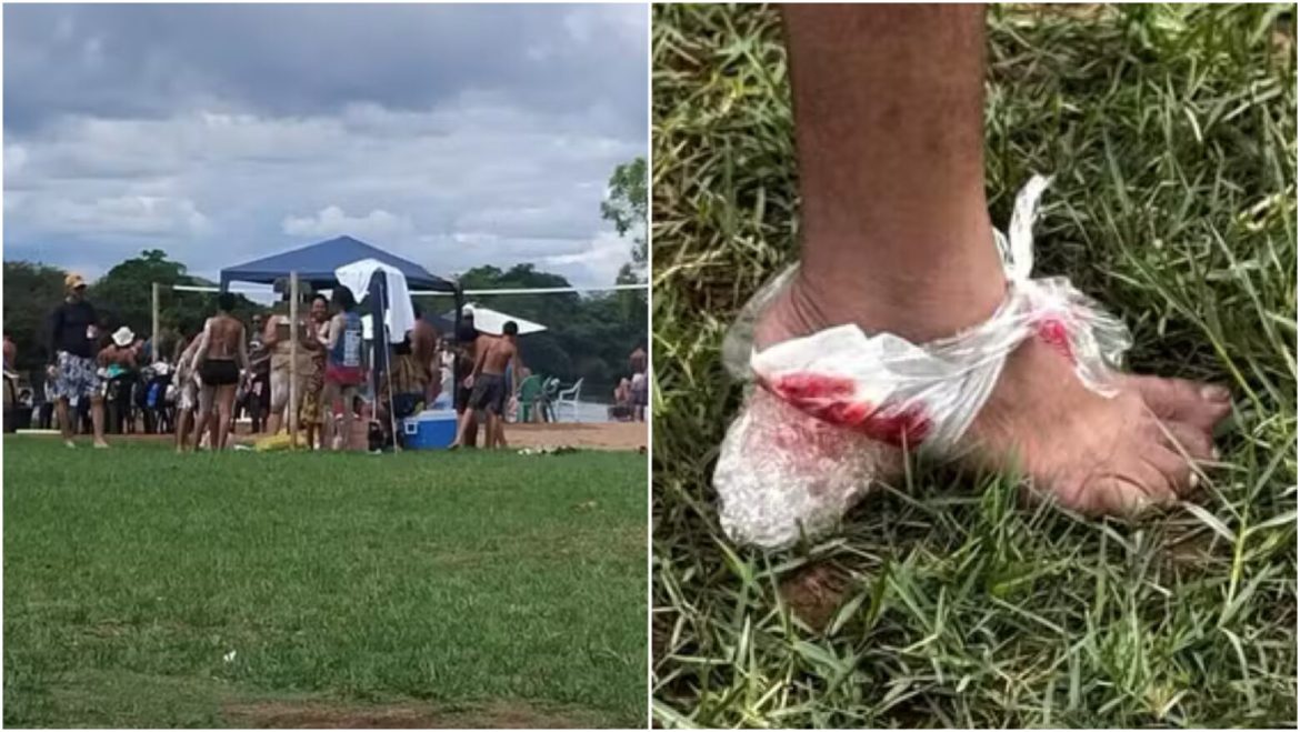 ataque-de-piranhas-deixa-feridos-no-rio-paraguacu